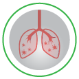 Pneumonia